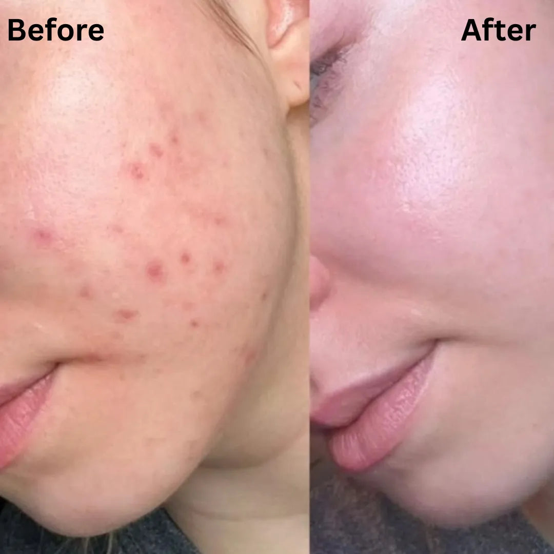 ClearSkin™ Patch Roll