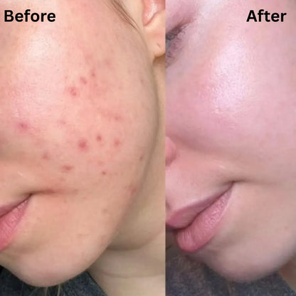ClearSkin™ Patch Roll